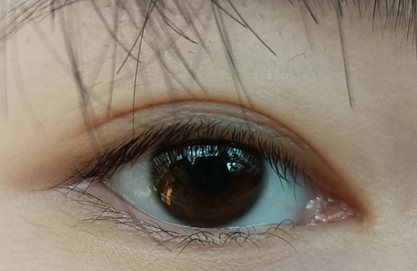 倒睫怎么辦？